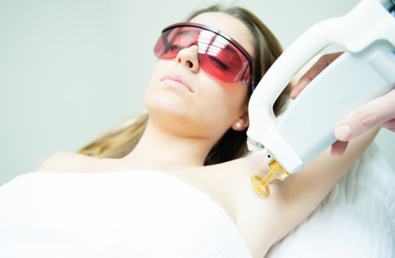 Laser Hair Removal